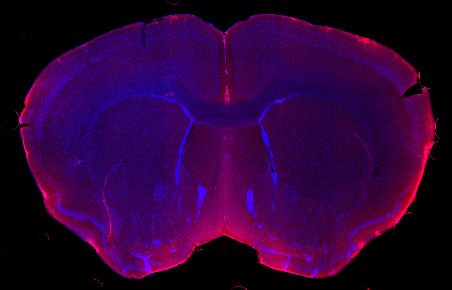 Cerebrospinal fluid (colored red) seeps into the brain tissue (blue) through tiny gaps in the blood vessels that run through the brain’s protective layers. 